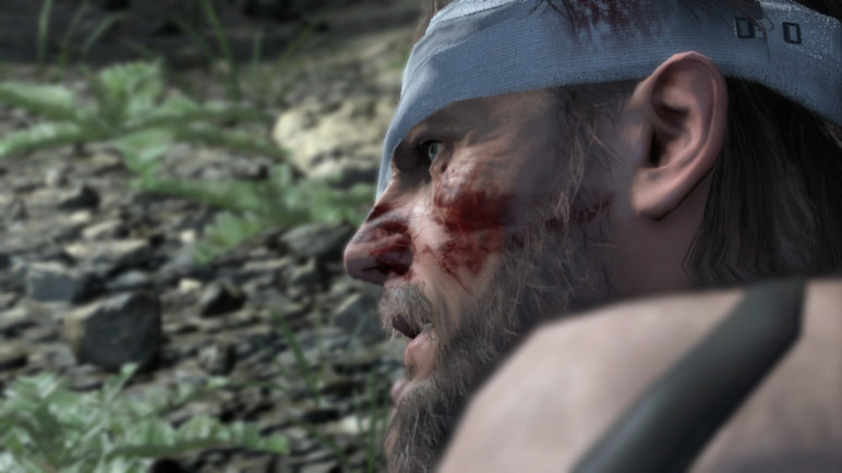 Review of Metal Gear Solid 5 The Definitive Experience – image 7